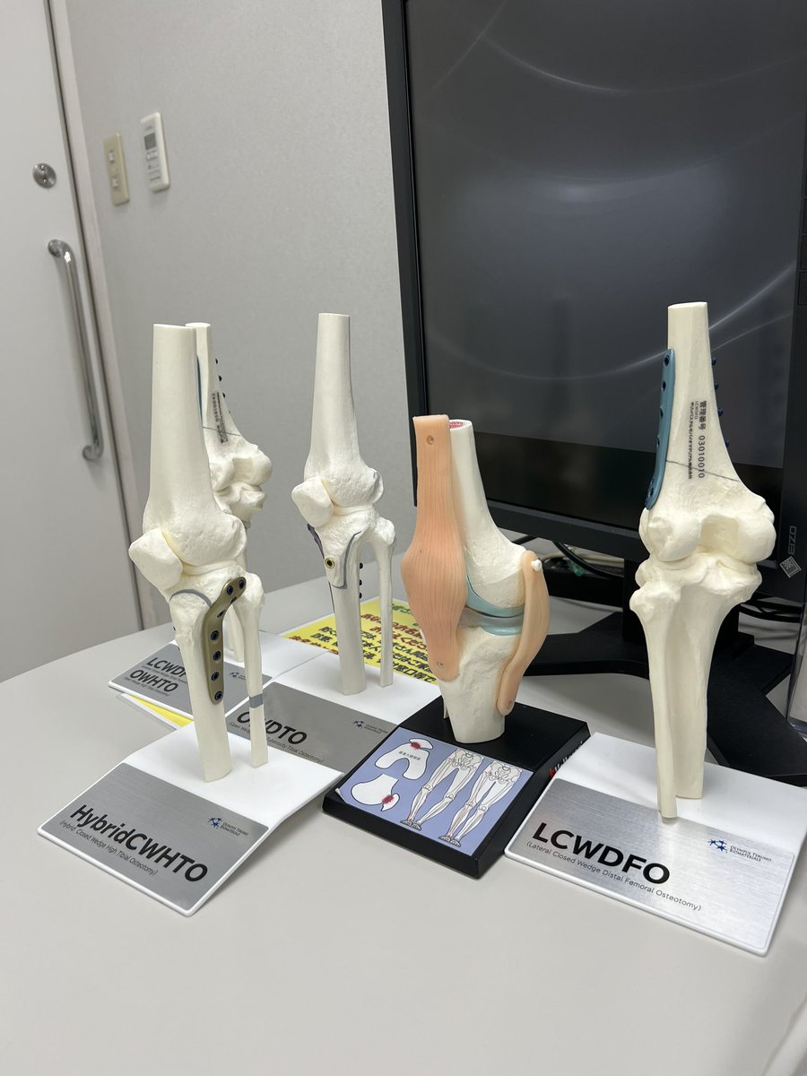 hiroshi0273's tweet photo. 膝スポーツ外来🦵
Outpatient clinic of the knee 🦵
#兵庫医科大学
#西宮回生病院
#大阪回生病院
#整形外科
#変形性膝関節症
#スポーツ復帰
#半月板損傷
#高位脛骨骨切り術
#膝周囲骨切り術
#遠位大腿骨骨切り術
#doublelevelosteotomy
#前十字靭帯損傷
#半月板縫合 https://t.co/u142vDPLB0