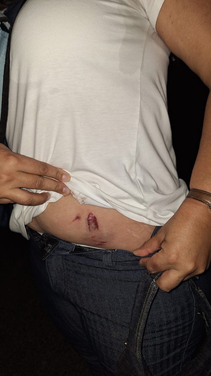 ciampanama's tweet image. Compártelo que esto no se ve en los medios tradicionales 
23 de octubre de 2023. Represión policial en Calle 50, Ciudad de Panamá  jóvenes que protestaban contra la Minería Metálica.
No hay argumentos ni razones solo represión contra la poblacion que se manifiesta @NitoCortizo