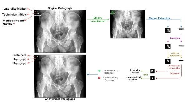 #DeepLearning algorithm selectively removes radiographic markers to enable deidentified data sharing doi.org/10.1148/ryai.2… <a href="/Mayo_OSAIL/">MayoOSAIL</a> <a href="/MayoRadiology/">Mayo Clinic Radiology</a> <a href="/CodyWylesMD/">Cody Wyles</a> #deidentification #ML #MachineLearning