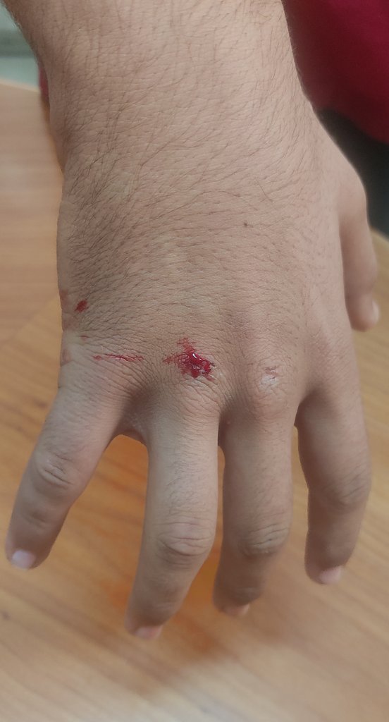 brans_anadil's tweet photo. Bu nedir Allah için?🤦🏻‍♀️Nerde saçma sapan, zarar verici, beyin yıkayıcı oyun varsa çocuklar arasında anında kabul görüyor.
Bizim yanlışlıkla elimiz değse bizden şikayetçi oluyorlar ama kendilerine bunu yaparken keyif alıyorlar.
Canın yanmıyor mu diyorum.
Hayır diyor.
Sadistlik bu🤦🏻‍♀️ https://t.co/xBJWr4qQWk