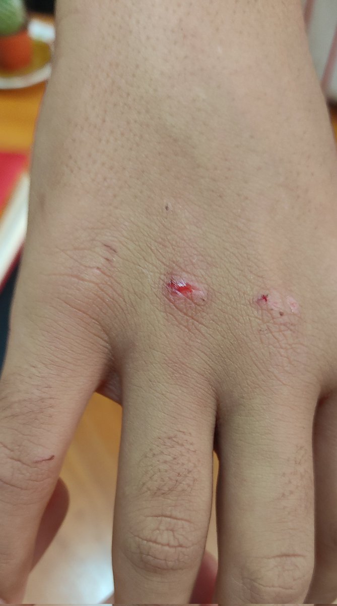 brans_anadil's tweet photo. Bu nedir Allah için?🤦🏻‍♀️Nerde saçma sapan, zarar verici, beyin yıkayıcı oyun varsa çocuklar arasında anında kabul görüyor.
Bizim yanlışlıkla elimiz değse bizden şikayetçi oluyorlar ama kendilerine bunu yaparken keyif alıyorlar.
Canın yanmıyor mu diyorum.
Hayır diyor.
Sadistlik bu🤦🏻‍♀️ https://t.co/xBJWr4qQWk