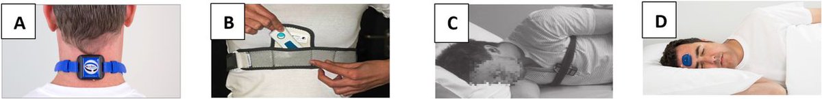 Efficacy of vibrotactile positional therapy devices on patients with positional obstructive sleep apnoea: a systematic review and meta-analysis thorax.bmj.com/content/78/11/… @alqarni_sleep @drchristurnbull