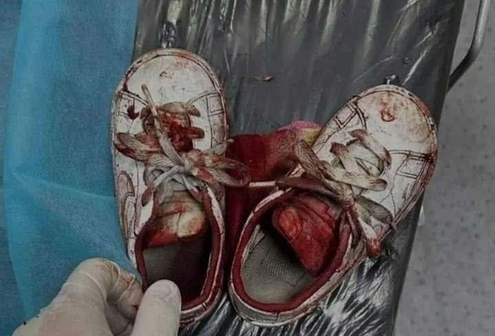 saraadim0's tweet photo. There is no longer humanity in this world The shoe explains a lot of that child's suffering To provide assistance to the Palestinian people
https://t.co/fsKQ8OVIfz https://t.co/3OS9FN8WEV