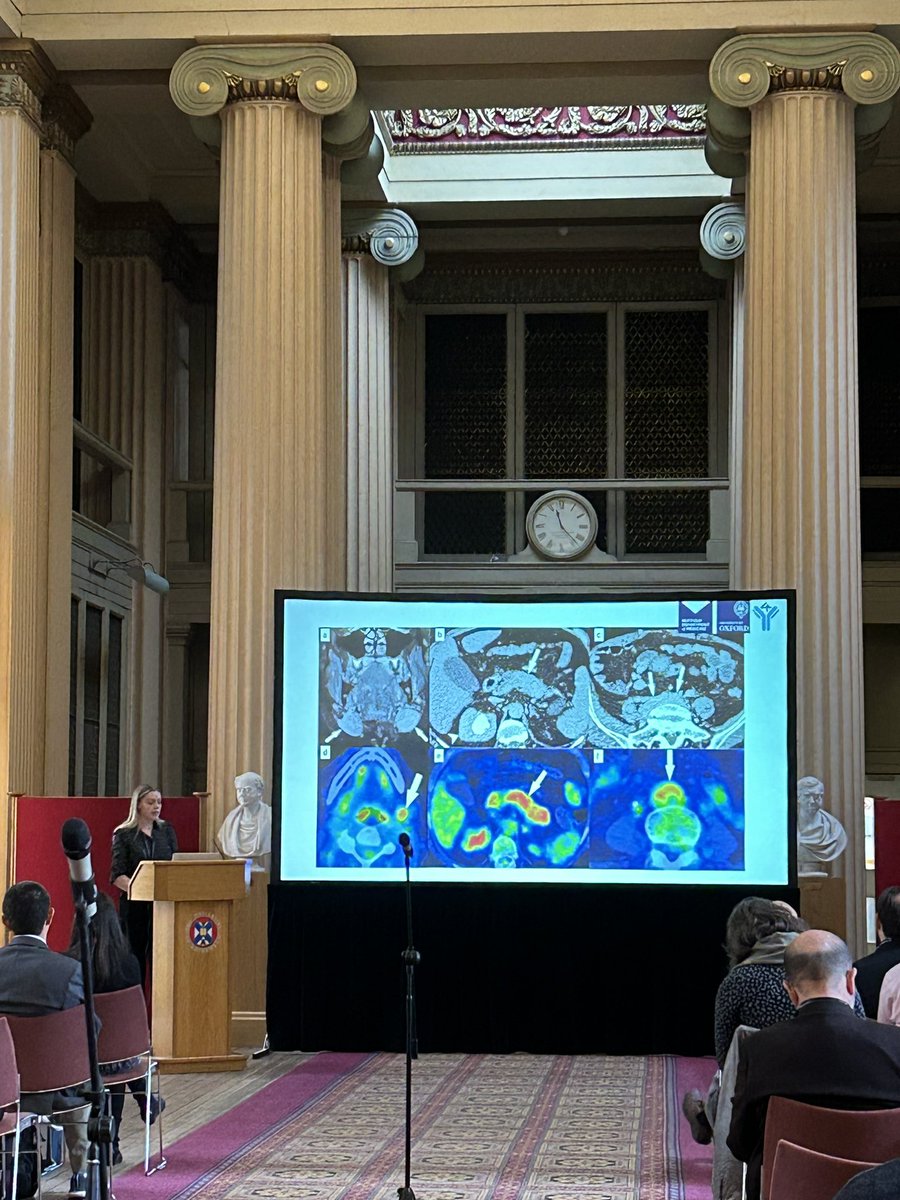 🎤Our final Proffered talk of the conference is from Zara Small “18F-FDG PET-CT identifies subclinical disease and disease activity in a
prospective IgG4-related disease UK cohort” for Clinical PET imaging. 

#PETisWonderful2023