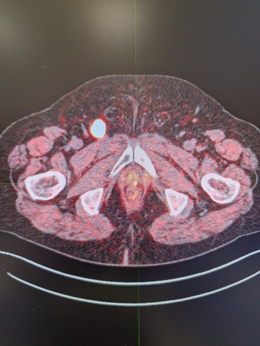 Carmelo Tuscano🇮🇹🇪🇺 tweet media