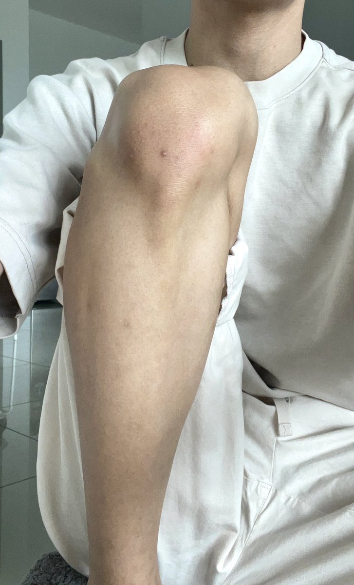notmijiiii's tweet photo. Wehhh my lutut macam “BONTOT KUALI” era dah habis!

It’s not that hard kena rajin scrub 2x seminggu pun dah cukup 🤧 https://t.co/9XHcgkFU0O