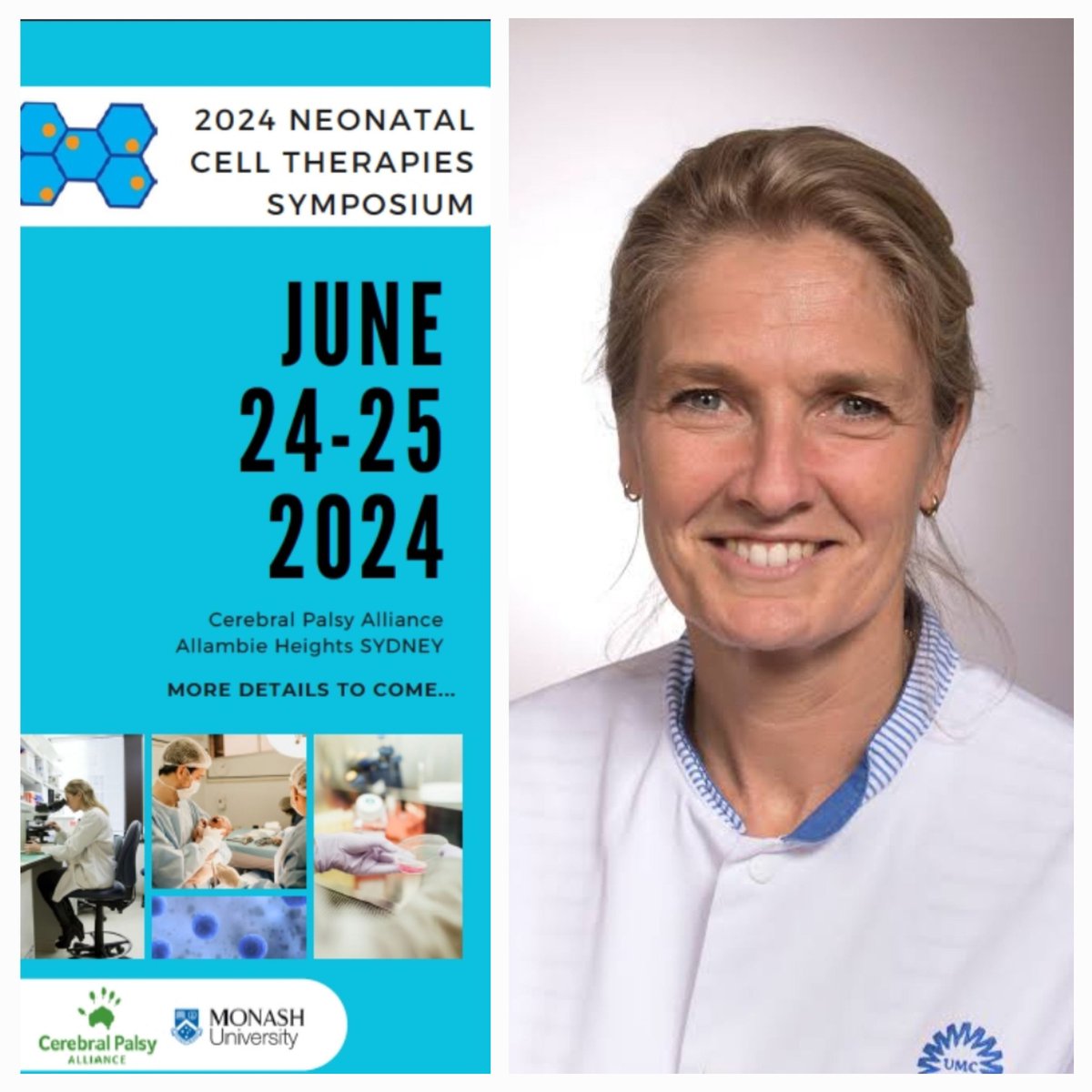 Atul Malhotra (@atul_monash) on Twitter photo Announcing first of our keynote speakers for the (2nd) Neonatal Cell Therapies Symposium to be held at <a href="/CPAllianceAU/">Cerebral Palsy Alliance</a> next year!
Prof Manon Benders from <a href="/NeonatalNeuroU/">Neonatal Neurology Utrecht</a> <a href="/UMCUtrecht/">UMC Utrecht</a>
Registration & abstract submission opening soon! Announcing first of our keynote speakers for the (2nd) Neonatal Cell Therapies Symposium to be held at <a href="/CPAllianceAU/">Cerebral Palsy Alliance</a> next year!
Prof Manon Benders from <a href="/NeonatalNeuroU/">Neonatal Neurology Utrecht</a> <a href="/UMCUtrecht/">UMC Utrecht</a>
Registration & abstract submission opening soon!
