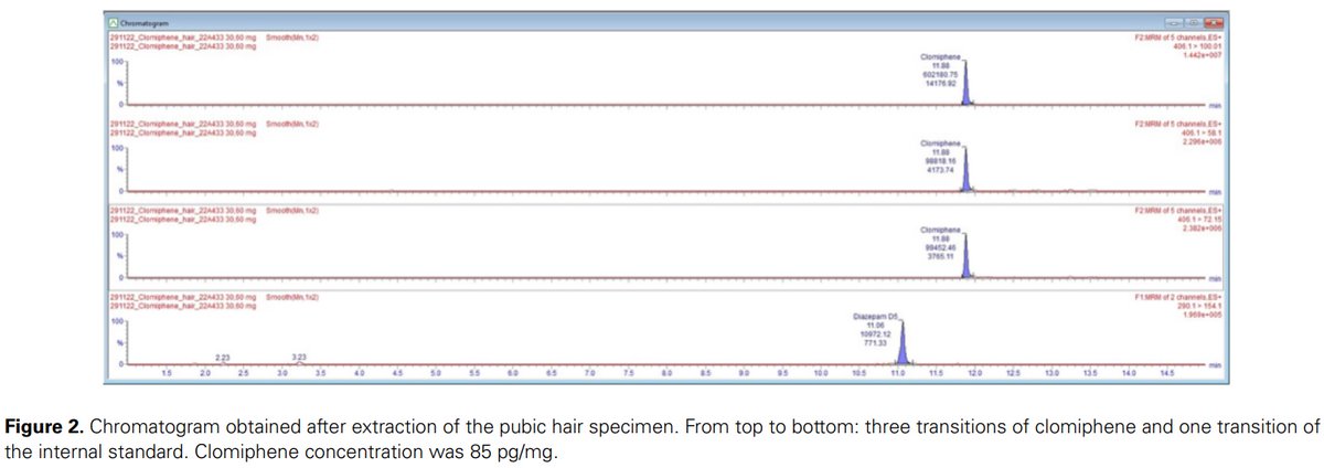 JAnalyticalTox's tweet photo. @pkintz et al. (incl. @LaurieGheddar and @AliceAmeline) tested keratinous matrices 💅💇‍♀️ for clomiphene, a selective estrogen receptor modulator prohibited by WADA. Want to know more? Read it all➡️https://t.co/aGSj2NIQY4 https://t.co/EPOMfNoeYG