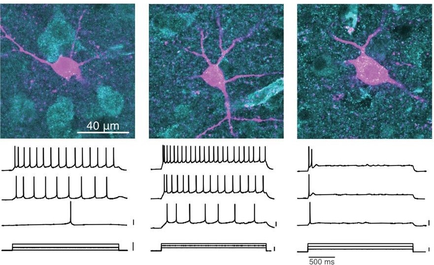 SfNJournals's tweet photo. #JNeurosci: Lu, @cdmeliza et al. @UVAPsyc @uvaneuro found that neurons in the developing zebra finch auditory cortex can rapidly shift their spiking dynamics within a few minutes in response to intracellular stimulation.
https://t.co/VmEM8hr1pn https://t.co/cPxHDofNzX