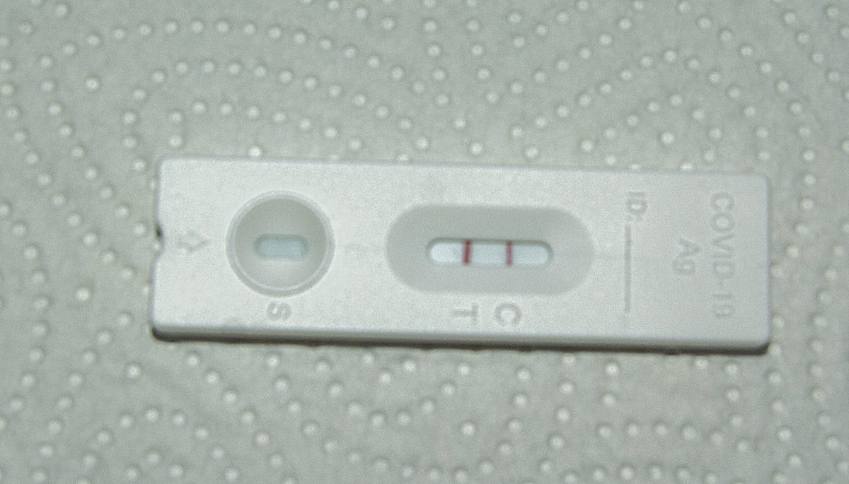 vertig0nix's tweet image. die wahrscheinlichkeit, nach rund 3,5 jahren und ca. 200 negativ tests den ersten #falsepositive erwischt zu haben,ist
a)sehr hoch
b)höher als sich nach 3,5 jahren tatsächlich corona einzufangen
c)scheißegal, willkommen im #3Gclub !

der 1. test, an &quot;symptomtag&quot; 3 übrigens