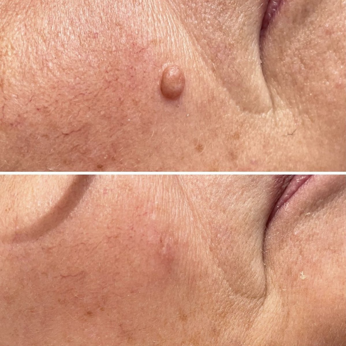 cb_aesthetics_'s tweet photo. Rebecca completed PTLLS at Chichester College and has used that knowledge to train experienced staff members across the country.

After working as a skin therapist for nearly 12 years, Becky expanded her knowledge in advanced cosmetic treatments and laser technology, treating a w https://t.co/FJ01XVRLW4