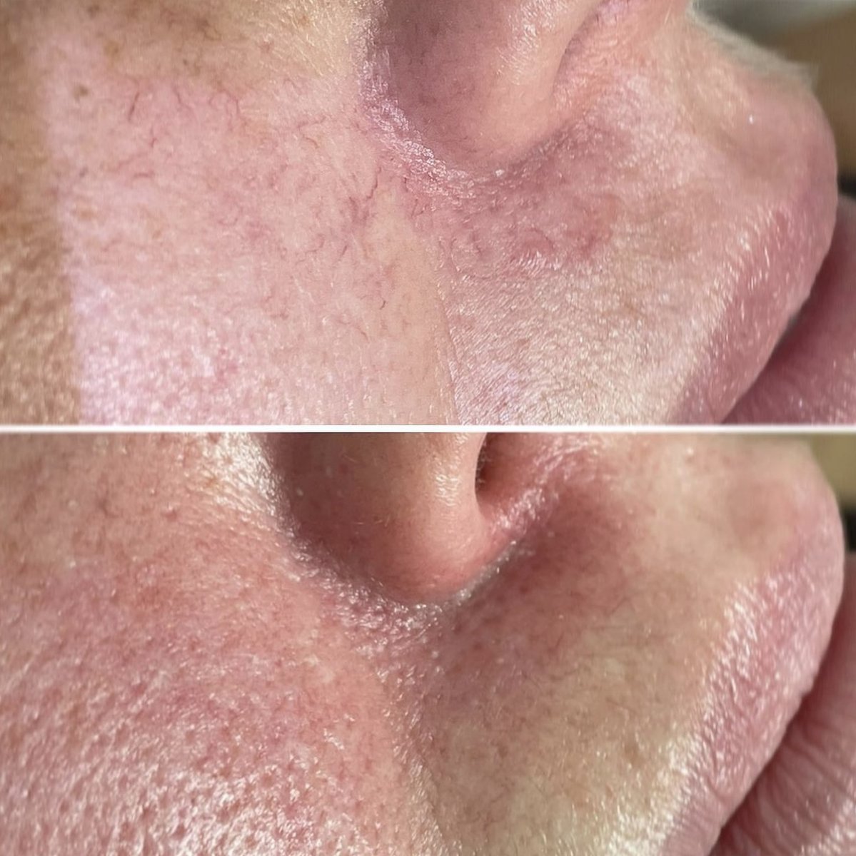 cb_aesthetics_'s tweet photo. Rebecca completed PTLLS at Chichester College and has used that knowledge to train experienced staff members across the country.

After working as a skin therapist for nearly 12 years, Becky expanded her knowledge in advanced cosmetic treatments and laser technology, treating a w https://t.co/FJ01XVRLW4