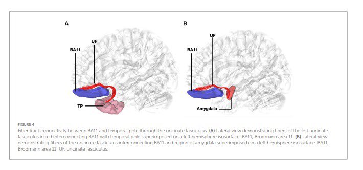 Syed Faraz Kazim, MD, PhD (@kazimsyed_neuro) on Twitter photo Recent paper by our PRF <a href="/GSkandalakis/">Georgios Skandalakis</a>. <a href="/UNMNeurosurgery/">UNM Neurosurgery</a> <a href="/UNMHSC/">UNM Health Sciences</a> <a href="/MichaelKogan20/">Michael Kogan</a>
frontiersin.org/articles/10.33… Recent paper by our PRF <a href="/GSkandalakis/">Georgios Skandalakis</a>. <a href="/UNMNeurosurgery/">UNM Neurosurgery</a> <a href="/UNMHSC/">UNM Health Sciences</a> <a href="/MichaelKogan20/">Michael Kogan</a>
frontiersin.org/articles/10.33…