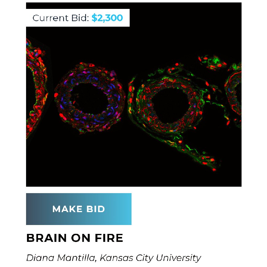 Always fun to see students do cool stuff to help others. 2022 @UVMLarnerMed @FAERanesthesia #MSARF MS2 @mrsquesatilla from @KansasCityU recently generated $2300 to support KC kids who are interested in #science and #STEAM programs using her IHC images. #SciencetoArt #Proud