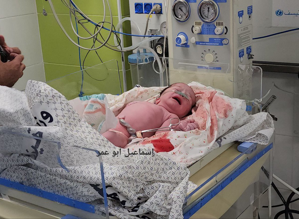 Timesofgaza's tweet photo. Born from the whomp of death; 
Palestinian girl was extracted from her dead mother’s whomp after the latter was killed in the lsraeli bombing. https://t.co/xdui6qewZH