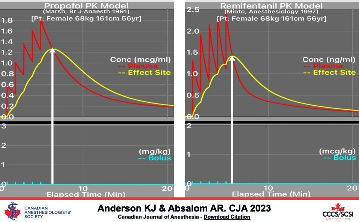 EDITORIAL

Propofol/remifentanil patient-controlled sedation: caveat emptor! - Canadian Journal of Anesthesia #CJA #CJA2023 #Anesthesia #Anesthesiology   buff.ly/3Fr5ii3