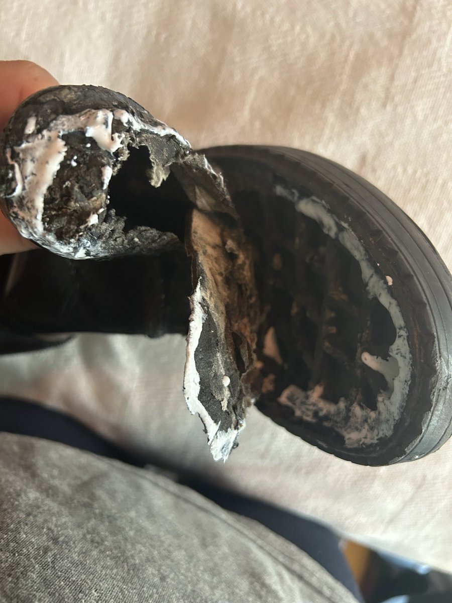 BukurijeNavon's tweet photo. Why do you think attacked me? For one pair of shoes? Cheep shoes? What do you think I should do about it? What about my education how should I pay for it, I should sell my old things and make money for new things, that’s one way but you ducked me out already so nothing left. https://t.co/HFXMHtyTju