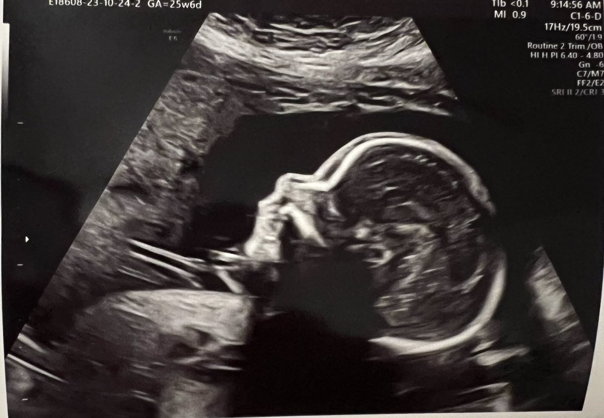 MoMoCupcakez's tweet photo. Meet baby R who is being evicted 1/24/24 !  So if you’re wondering why we have been mia , now you know :) https://t.co/mfVePtNvvw
