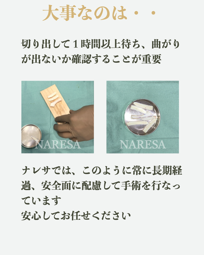 Dr_Sumida's tweet photo. 「肋軟骨の鼻整形は曲がるのか？」

患者さんから直接聞かれたり、SNSなどでも時々見かけるこの質問
論文の報告によると、その確率は3%といわれています

有名なお話として、肋軟骨にはワーピングといって、切ると曲がる可能性があります
では、その3%にならないためには、祈るしかないのでしょうか？

そんなことはなく、実は肋軟骨による曲がりはかなり防ぐことができます

まず大事になってくるのは、肋軟骨の“切り方”です
現在曲がりを抑える切り方で確立されているのは、この２通り

水平に真っ直ぐ切る方法と、斜め30度で切る方法です
これらの方法は曲がる可能性が低く、両者に差もほとんどないといわれています

次に大事なのは、“見極め”です
こちらも論文で明らかになっていますが
切ってから１時間の曲がりと、３ヶ月の曲がりにはほぼ差がありません

なので、切ってから１時間待ち、その中で曲がりのない肋軟骨を選べば
長期的に見ても曲がることはまず無いといえます

ということで、肋軟骨の曲がる性質ワーピングに関しては
かなり防ぐことができるとお分かりいただけたと思います

ただし、鼻整形では曲がりを防ぐための前提としてとても大事なことがあります
それが手術前の診断と計画です
いくら曲がらない材料を使ったとしても
元の土台が曲がっていてそのまま伸ばせば、曲がりは強く出ます
また、耳介軟骨のような柔らかい素材で無理にたくさん伸ばせば
曲がる可能性は高くなります

なので、手術前に曲がりの程度やパターンをしっかりと把握し
そもそも希望の形は実現可能なのか？
それにはどんな材料が必要か
そして、どのように手術で組み立てていくか

鼻整形で曲がりを防ぐには、これらがより重要言えるのです