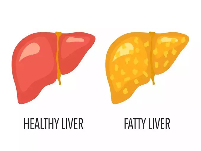 Warning signs that your liver need a detox 
White/yellow-coated tongue
Bad breath
Feeling tired/fatigued
Weight gain
Feeling nauseous
Weak digestion
Itchy skin
Skin breakouts
Headaches 
Eczema or rosacea
#Fitistan #FitBharat