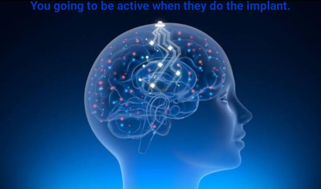 Sandy09990325's tweet photo. @neuralink That's wonderful the patient they're not going to feel no pain at all just a little touch and they are done. https://t.co/Durf8ChkzO