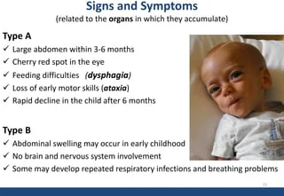 Niemann Pick Disease - an overview