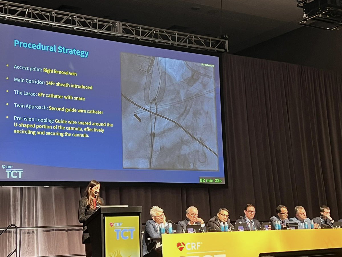 🌟 Thrilled to have presented at #TCT2023 in San Francisco! 🫀Shared insights on managing post-LVAD RV Failure & navigating challenges with a mal-positioned dual lumen V-V ECMO cannula. #CardioTwitter @HFHCardioFellow @HFHIntMedRes @AlQarqazM @Babar_Basir @herbaronowMD