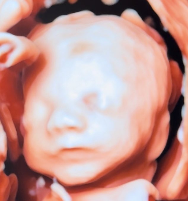 David Marvin tweet media