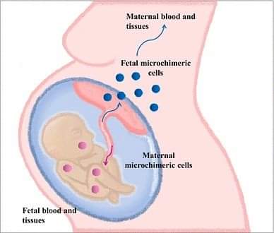 afshineemrani's tweet photo. God's miracles:
“When pregnant, the cells of the baby migrate into the mothers bloodstream and then circle back into the baby, it’s called “fetal-maternal microchimerism”.
For 41 weeks, the cells circulate and merge backwards and forwards, and after the baby is born, many of these cells stay in the mother’s body, leaving a permanent imprint in the mothers tissues, bones, brain, and skin, and often stay there for decades. Every single child a mother has afterwards will leave a similar imprint on her body, too.
Even if a pregnancy doesn't go to full term or if you have an abortion, these cells still migrate into your bloodstream.
Research has shown that if a mother's heart is injured, fetal cells will rush to the site of the injury and change into different types of cells that specialize in mending the heart.
The baby helps repair the mother, while the mother builds the baby.
Truly beautiful.
This is why certain illnesses vanish while pregnant.
It’s incredible how mothers bodies protect the baby at all costs, and the baby protects & rebuilds the mother back - so that the baby can develop safely and survive.
Studies have also shown cells from a fetus in a mothers brain 18 years after she gave birth.
Through pregnancy, it appears the mother gains cells that may have therapeutic potential. Fetal microchimerism contributes to the mother's ability to repair damaged or unhealthy tissue, which may be of relevance for long-term maternal health, regulation of ageing and control of longevity. Future human studies of fetal microchimerism must focus on characterizing the fetal cell type involved, resolving the debate on which stem cell type is responsible and also establishing the competitive advantage of fetal stem cells over the endogenous adult stem cell population.
The pregnancy-acquired low-grade chimeric state of women could have far-reaching implications, influencing recovery after injury or surgery, ageing, graft survival after transplantation, survival after cancer as well as deciding the protective effect of pregnancy against diseases later in life. Lifelong persistence of fetal cells in maternal tissues may even explain why women live longer than men.