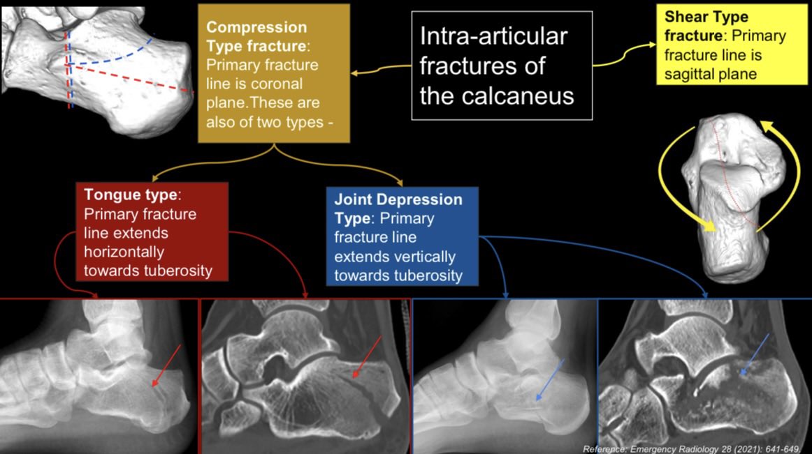drdevrad's tweet image. The relief after submitting #RSNA2023 educational exhibit is unparalleled, not least because of the change in the presentation system! Had so much fun making this &amp;amp; learning from my superb mentors and co-authors despite the stress of a looming deadline during Durga Pujo/Navratri!