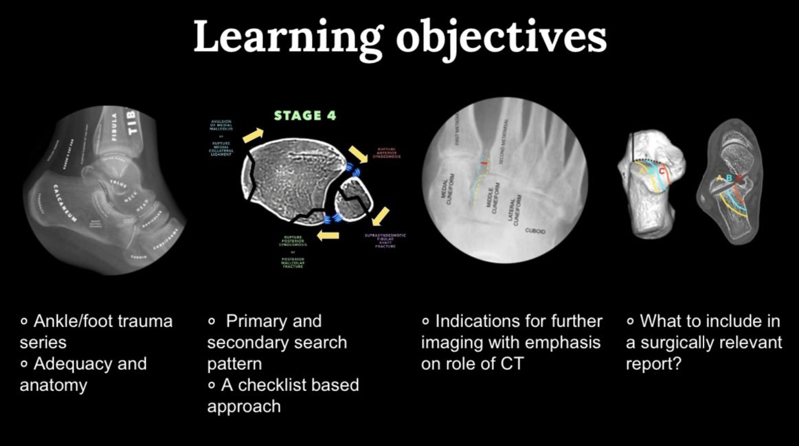 drdevrad's tweet image. The relief after submitting #RSNA2023 educational exhibit is unparalleled, not least because of the change in the presentation system! Had so much fun making this &amp;amp; learning from my superb mentors and co-authors despite the stress of a looming deadline during Durga Pujo/Navratri!