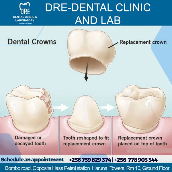 Dredental's tweet photo. Crown Your Smile with Confidence!
Regain strength and beauty with dental crowns! Our custom crowns are tailored just for you, ensuring a seamless fit and a stunning smile. Ready to crown your confidence? Book now! 👑😊
 +256 759 829 374☎️ +256 778 903 344🦷❤️
#FamilyDentistry https://t.co/Hk2S7GZCol