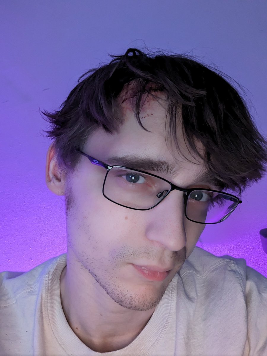 yoshemitzu's tweet photo. Friends,

Two nights ago, during a stream, I experienced a seizure, and I'm told (I don't remember) I started shaking violently, screaming, and then smashed my head into the concrete floor.

I'm feeling better now, but suffice to say, this has been a new experience. https://t.co/FvTeqd9yCO