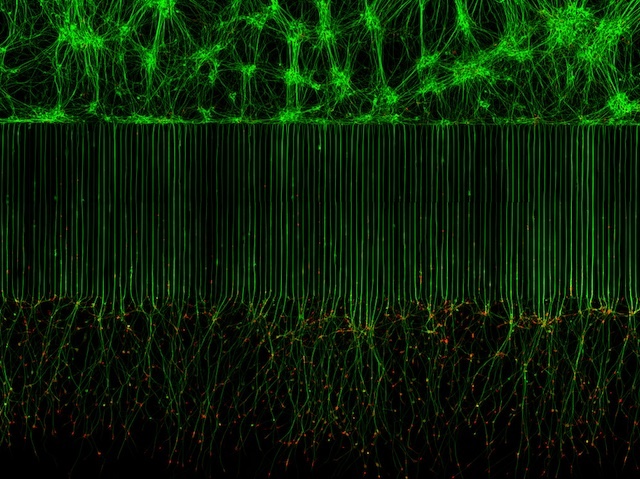 Biomedical Picture of the Day BPoD (@bpod_s) on Twitter photo Delighted to show a selection of finalists from #NikonSmallWorld. In 10th place <a href="/MelsNeurons/">Melinda Beccari</a> & Dr. Don W. Cleveland <a href="/UCSanDiego/">UC San Diego</a> with their image of motor #neurons grown in a microfluidic device for separation of cell bodies (top) and axons (bottom). On bpod.org.ac.uk/archive/2023/1… Delighted to show a selection of finalists from #NikonSmallWorld. In 10th place <a href="/MelsNeurons/">Melinda Beccari</a> & Dr. Don W. Cleveland <a href="/UCSanDiego/">UC San Diego</a> with their image of motor #neurons grown in a microfluidic device for separation of cell bodies (top) and axons (bottom). On bpod.org.ac.uk/archive/2023/1…