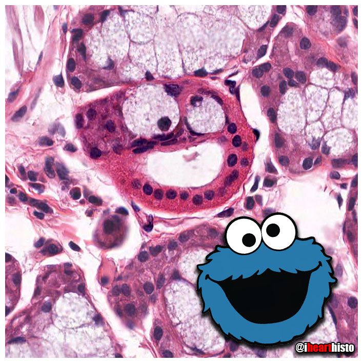 🍪💦 Cookie Monster Gland 💦🍪

Today's ihearthisto is brought to you by the letter S for Sublingual!

i♡histo
ihearthisto.com

A mixed (but mainly mucus) salivary gland with some adorable serous demilunes and a smiling intralobular duct.

#histology #anatomy #pathology