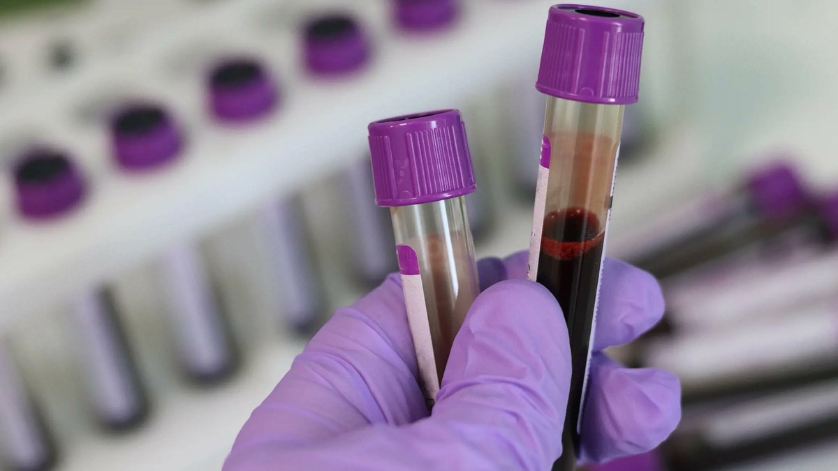 EspanaenUE's tweet photo. #COREPERI | EU ambassadors have agreed the @EUCouncil negotiating mandate on the regulation on blood, tissues and cells.

The rules ensure better protection of donors, recipients and children born following medically assisted reproduction.

🔗 https://t.co/GqgS0qe2DA

#EU2023ES https://t.co/zEpKixtAFq