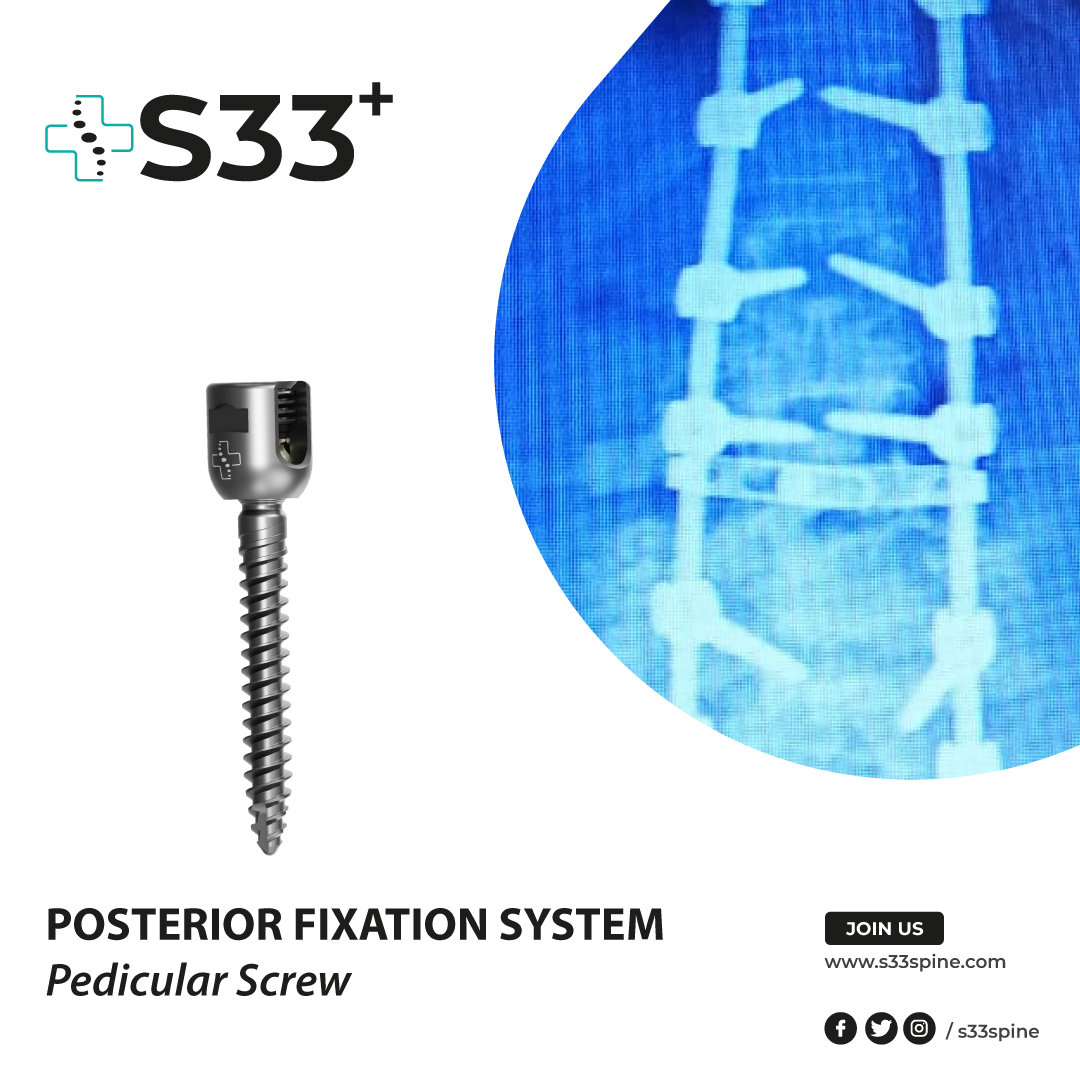 🎯 Posterior Fixation Systems
🎯 Pedicular Screws

#s33spine #spinehealth #spinesurgery #spinedoctor #spinedevice #spineimplants #surgeryinstruments #spinesurgeryinstruments #orthopedicsurgery #thoracolumbarfusion #PedicleScrews #pedicularscrews