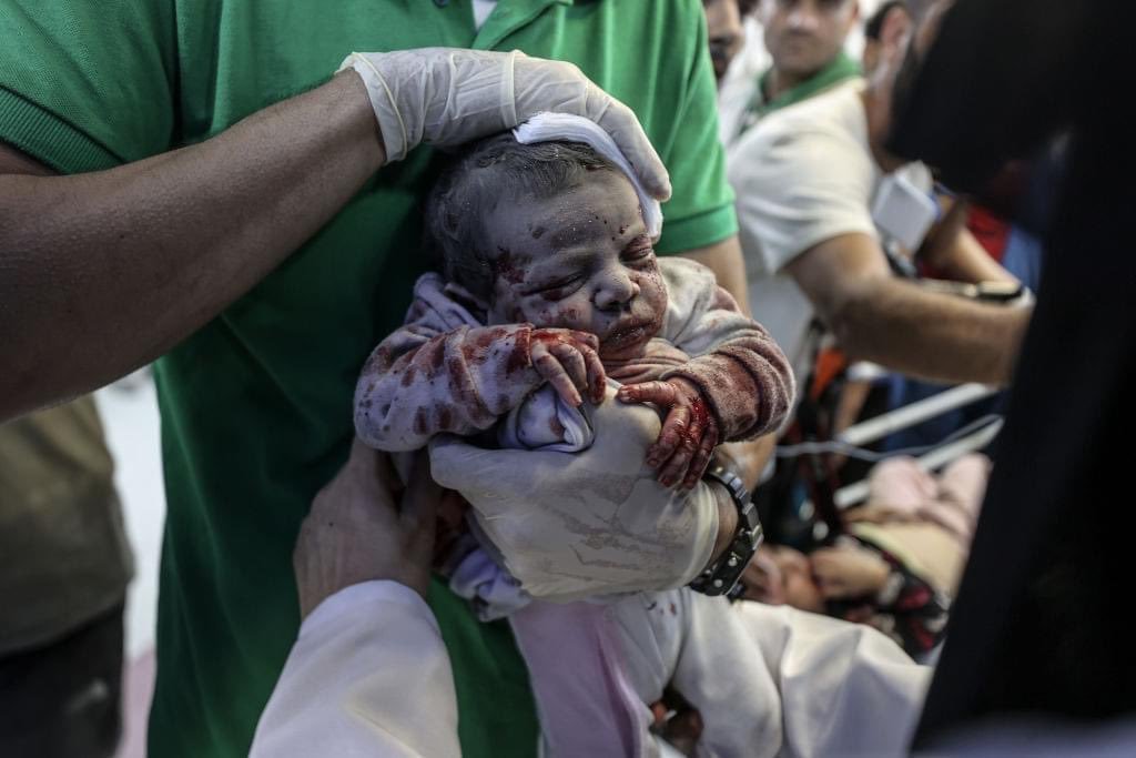 Al__Quraan's tweet photo. O Allah, help and protect the people of Palestine. O Allah, ease their pain and suffering. O Allah, bestower of Mercy, bestow your mercy on them. 

Allah is sufficient for us, and He is the best disposer of affairs. (3:173)

- Children of Gaza 🇵🇸💔 https://t.co/qPo0peFvKa