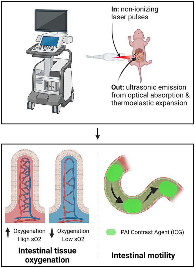 📢#NewPub Alert! New Wake Forest publication unveils breakthrough in neonatal research: "Photoacoustic Imaging as a Novel Non-invasive Biomarker to Assess Intestinal Tissue Oxygenation and Motility in Neonatal Rats." 🐀🔬 Check it out!➡️ pubmed.ncbi.nlm.nih.gov/37858392/ #NeonatalResearch