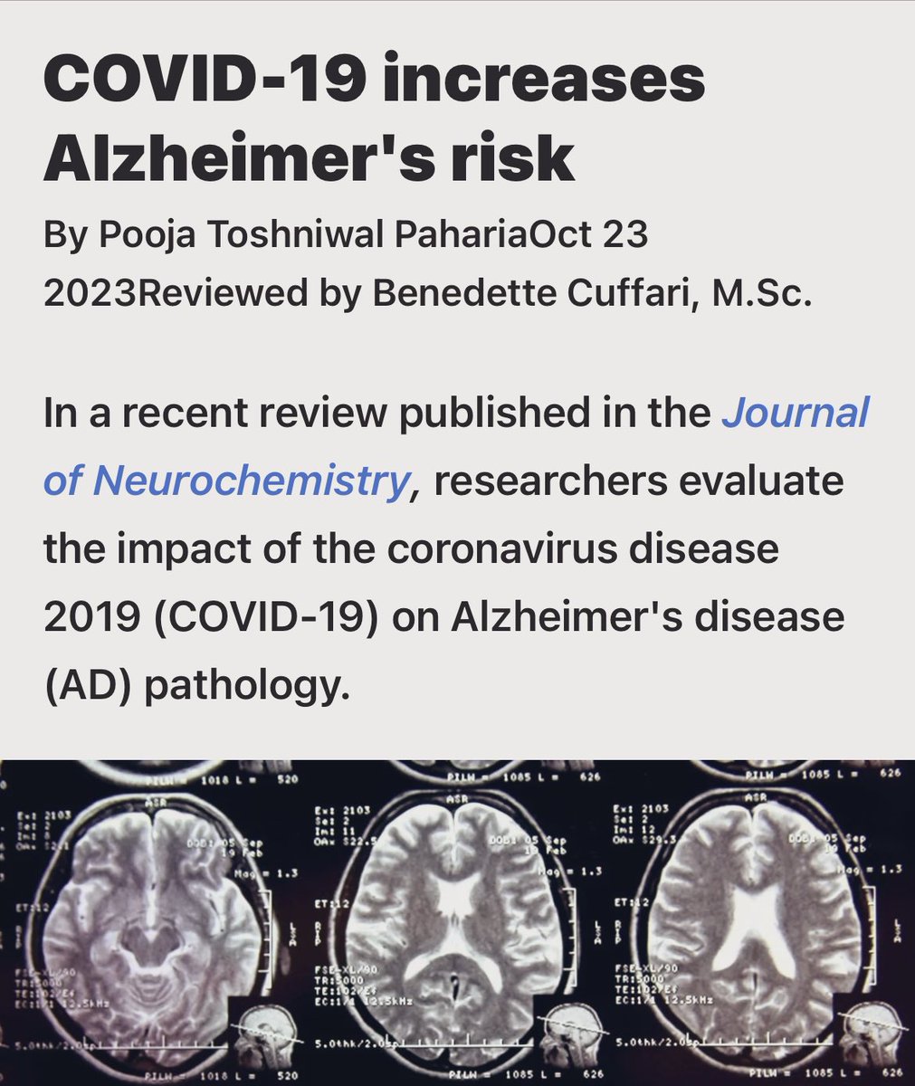 Again, remember when I said “loss of taste & smell” should never be classified as “mild”. That it’s brain dysfunction. Remember when I said there are more consequences to COVID than just death? Well, this is what I meant. 👇🏽

#WearAN95Mask #COVIDBooster