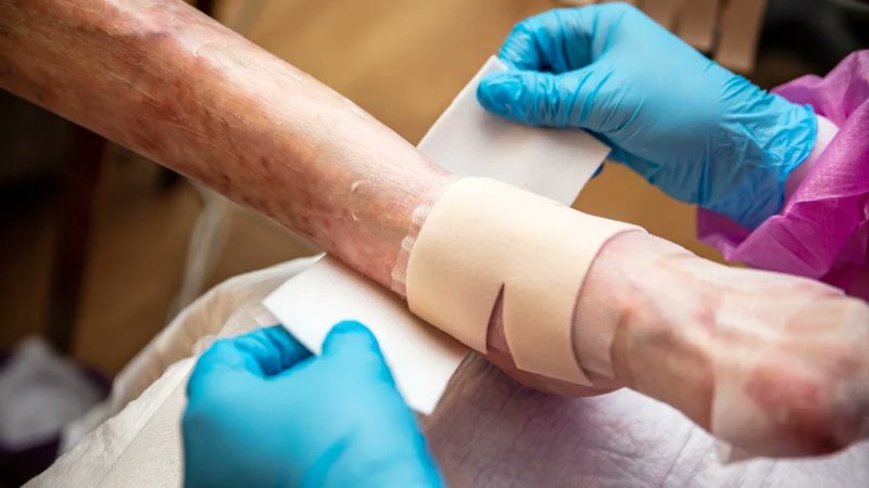 New UL research has revealed that the economic burden of caring for people with a devastating skin condition in Ireland exceeds €130,000 a year per patient. The international review was conducted by the Kemmy Business School for Debra. Read more: rte.ie/news/2023/1024…