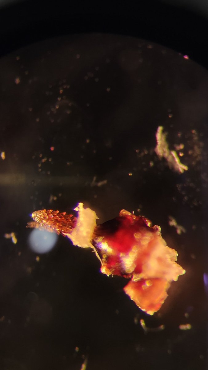 2 dermal punch biopsies from different patients in the lab today. Same end result diagnosis. These were disected out from the tissue. What do you see here? 
Thank God it is almost ❄️🌨
#parasitology
<a href="/ParasiteGal/">Bobbi Pritt, MD</a>
<a href="/ARUPLabs/">ARUP Laboratories</a>