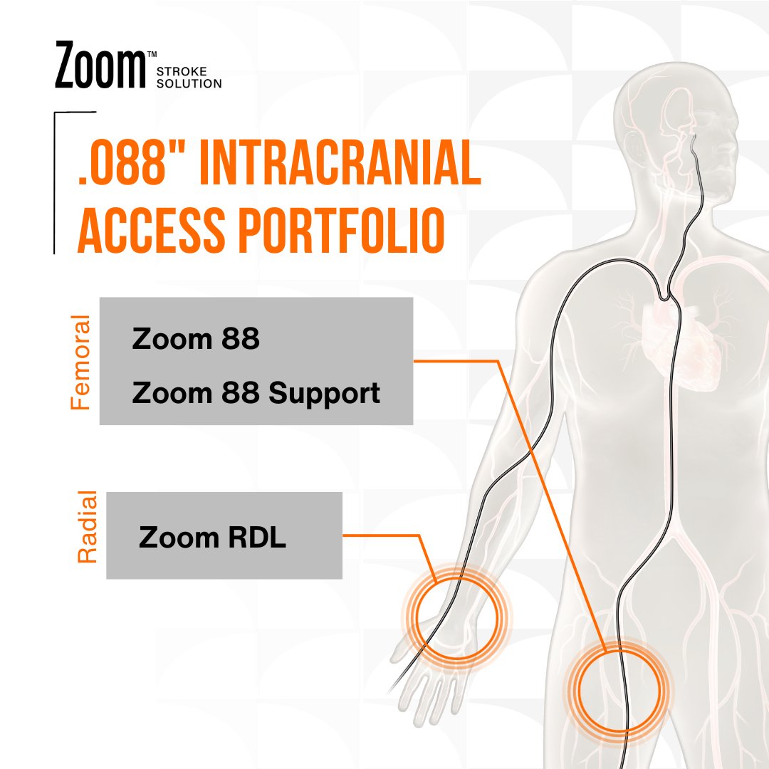 ImpCare_Stroke's tweet photo. Consistently reach intracranial anatomy and gain more control over your stroke procedures! Our portfolio includes three options for achieving .088” intracranial access, enabling the best possible outcome based on the anatomy of each patient. #Zoom88, #Zoom88 Support, #ZoomRDL.
Rx only. ISI: https://t.co/20ZwfcfdLU