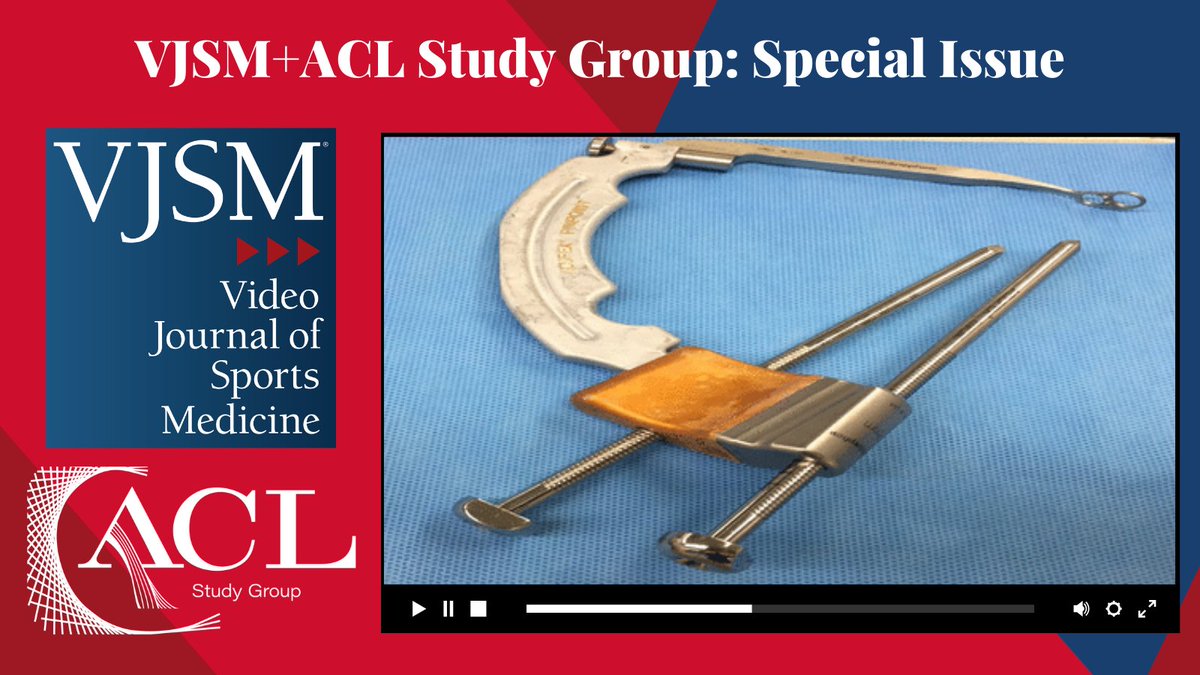 Attention ACL surgeons! Check out this new #ACLStudyGroupVJSM video showing a novel 2-in-1 guide for double bundle tibial ACL reconstruction! Link: ow.ly/qZfr50PXoUF