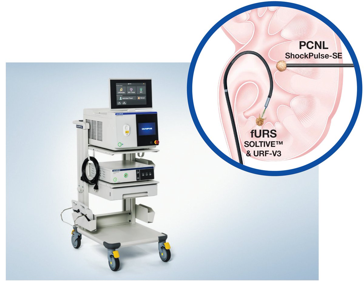 OlympusUrology's tweet photo. Discover the Olympus Full Lithotripsy Solution
With #Shockpulse-SE from above and #SOLTIVE from below, we bring stone management full circle.
Our convenient cart holds both systems for a seamless stone treatment experience #StoneManagement
Learn more
https://t.co/KVUulHSOxH https://t.co/N2A33Ogpp3