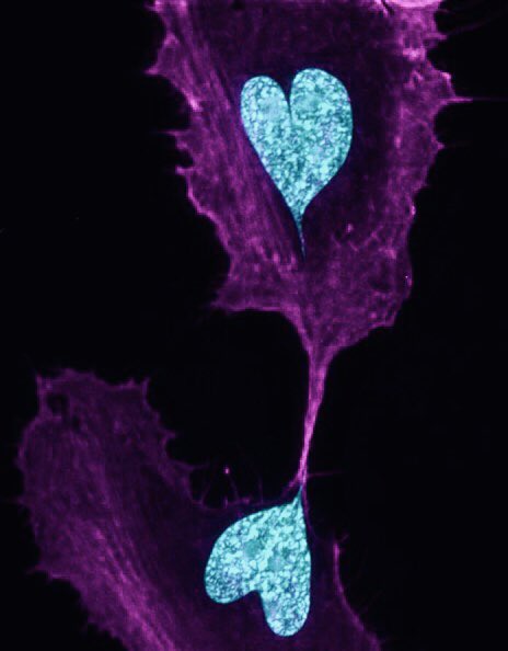microscopicture's tweet photo. two cells post-division with heart-shaped nuclei https://t.co/nOp6E3t2uI