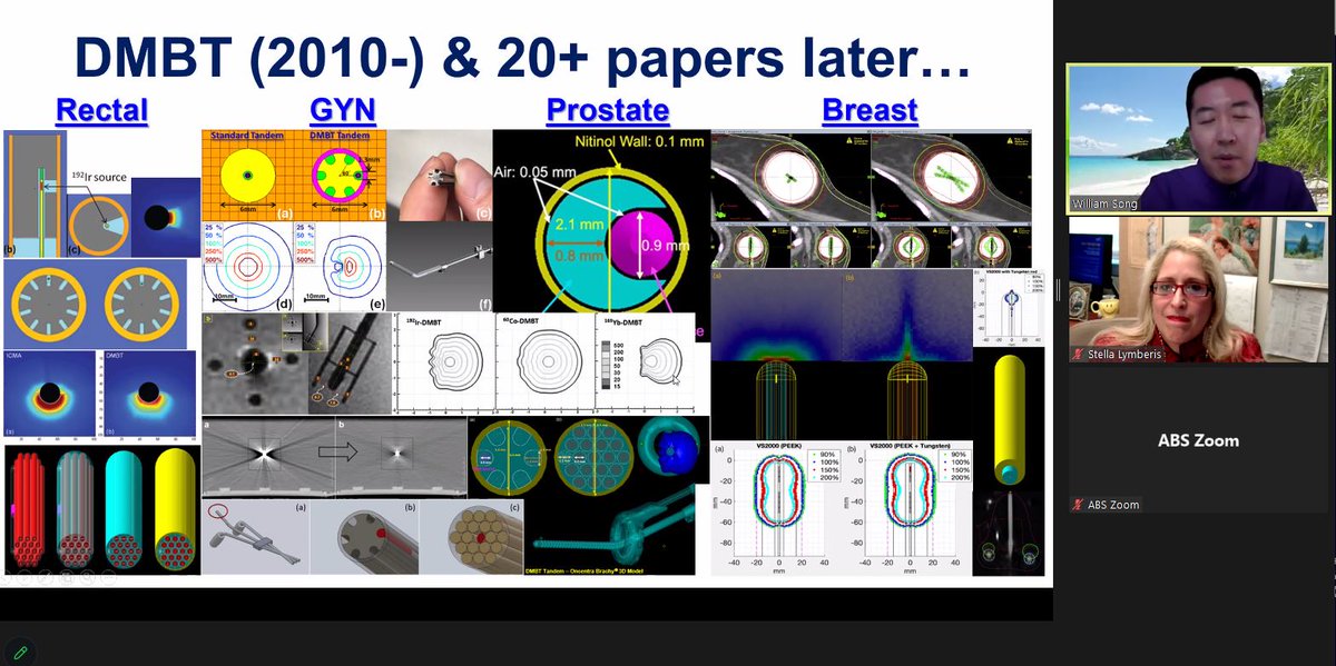 Moderated @AmericanBrachy Webinar w William Song, PhD presenting Direction Modulated Brachytherapy using a tungsten tandem which can potentially convert interstitial to intracavitary for cervix #brachy 
americanbrachytherapy.org/meetings-event…
#ThisIsBrachytherapy