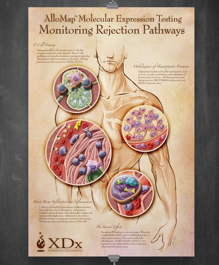 Medillustrates's tweet photo. XDx Inflammatory Pathways Poster by Paula Adduci | Adduci Studios.
Explore more work by Adduci Studios: https://t.co/F0fwYMPoKk
#allomap #geneexpression #inflammatorypathways #inflammation #illustration #medicalillustration #endocrinology #cardiology #diseasemanagement #sciart https://t.co/bw6jG3dKRE
