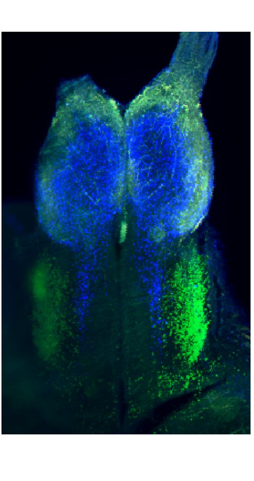Cleared cavefish adult telencephalon. Green = th1 and Blue = sst1