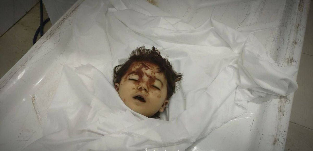 تبًا لكم وقوانينكم وحقوق إنسانكم، فهي ليست قوانينا وليست حقوق إنساننا .
 May you and your human rights be damned. They are not our laws and principles and they are not our human rights. 

اللهم نصرك يا نعم المولى ويا نعم النصير.